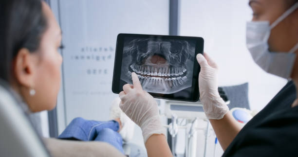 Licensed Tooth Extraction service in Johnson City, NY - Smile Center Dentistry